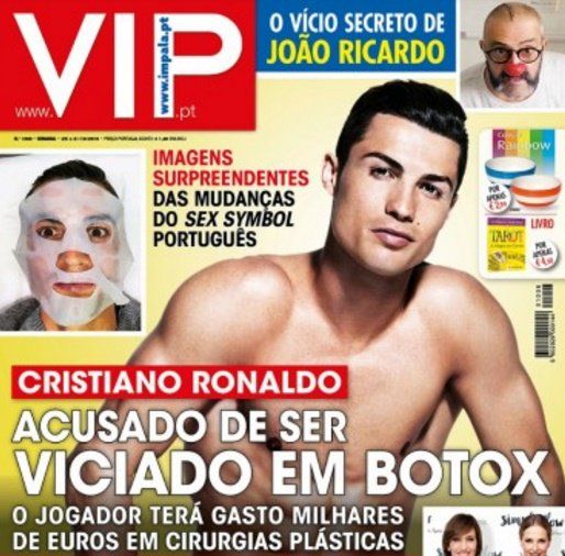 Cristiano Botox